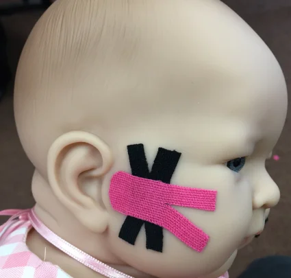 What is Therapeutic Taping?
